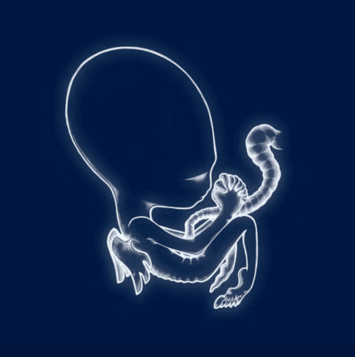 Ágætis byrjun
